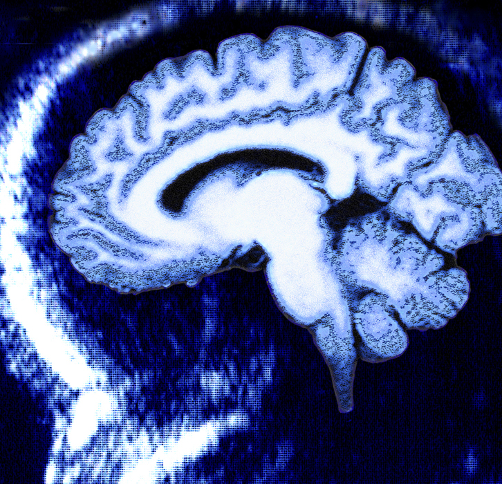 Neurosequential Model of Therapeutics (NMT)